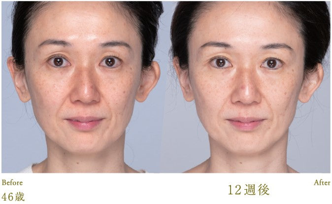 LUCIA Esthetic Skin Facial Mask (5 sheets)