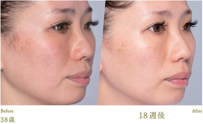 LUCIA Esthetic Skin Cream 30g